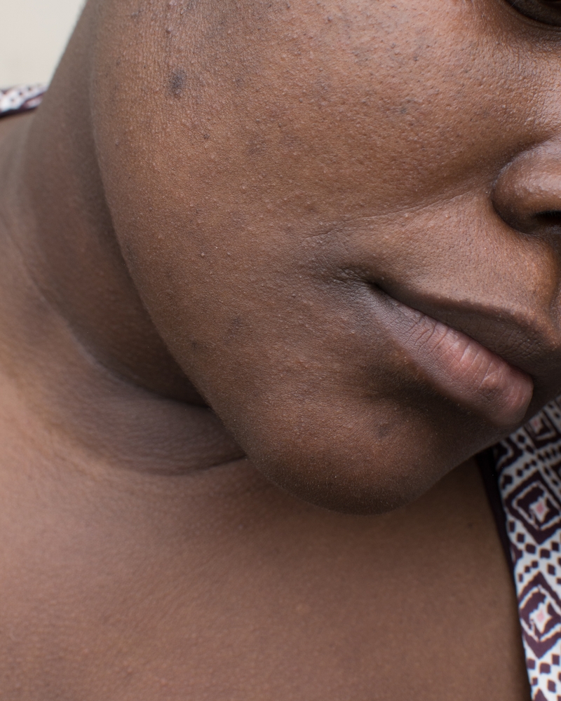 How to Reduce the Appearance of Large Pores